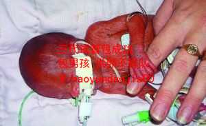 上海代孕双胞胎_35岁就要考虑试管了吗_怎样做试管婴儿视频_试管婴儿的过程视
